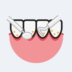 Periodontal Assessment