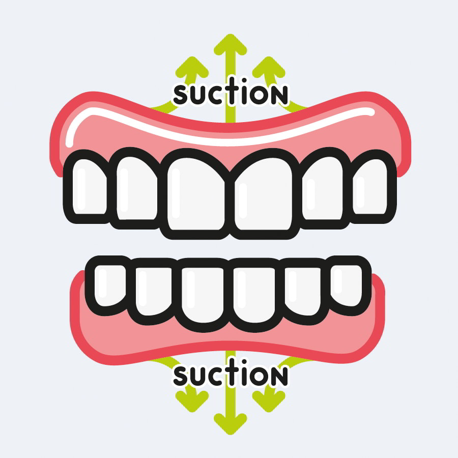 Suction Dentures