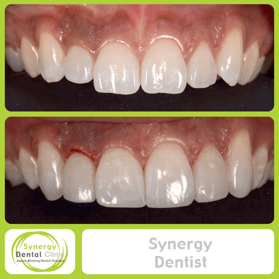 Synergy Dentist 4