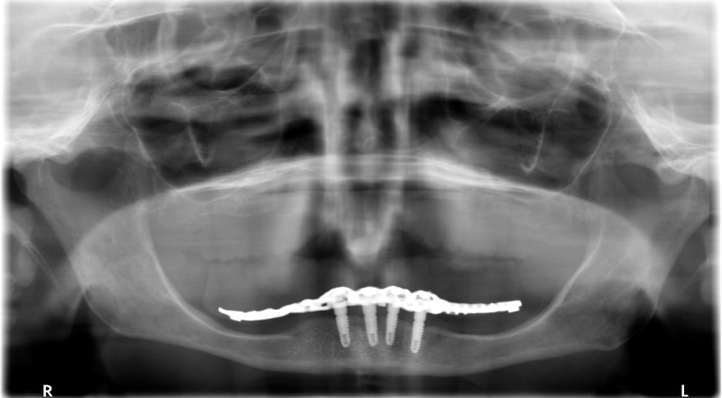 Synergy Dental Clinics - Dental Case Studies