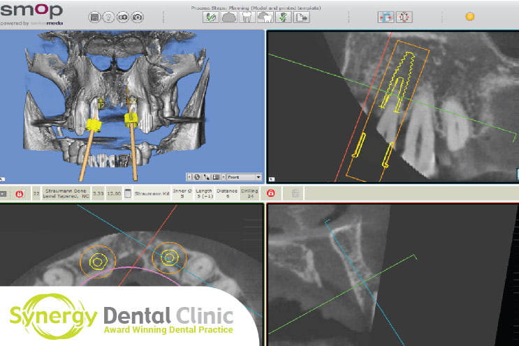 Case Study Will I Have an X-Ray or CT-Scan