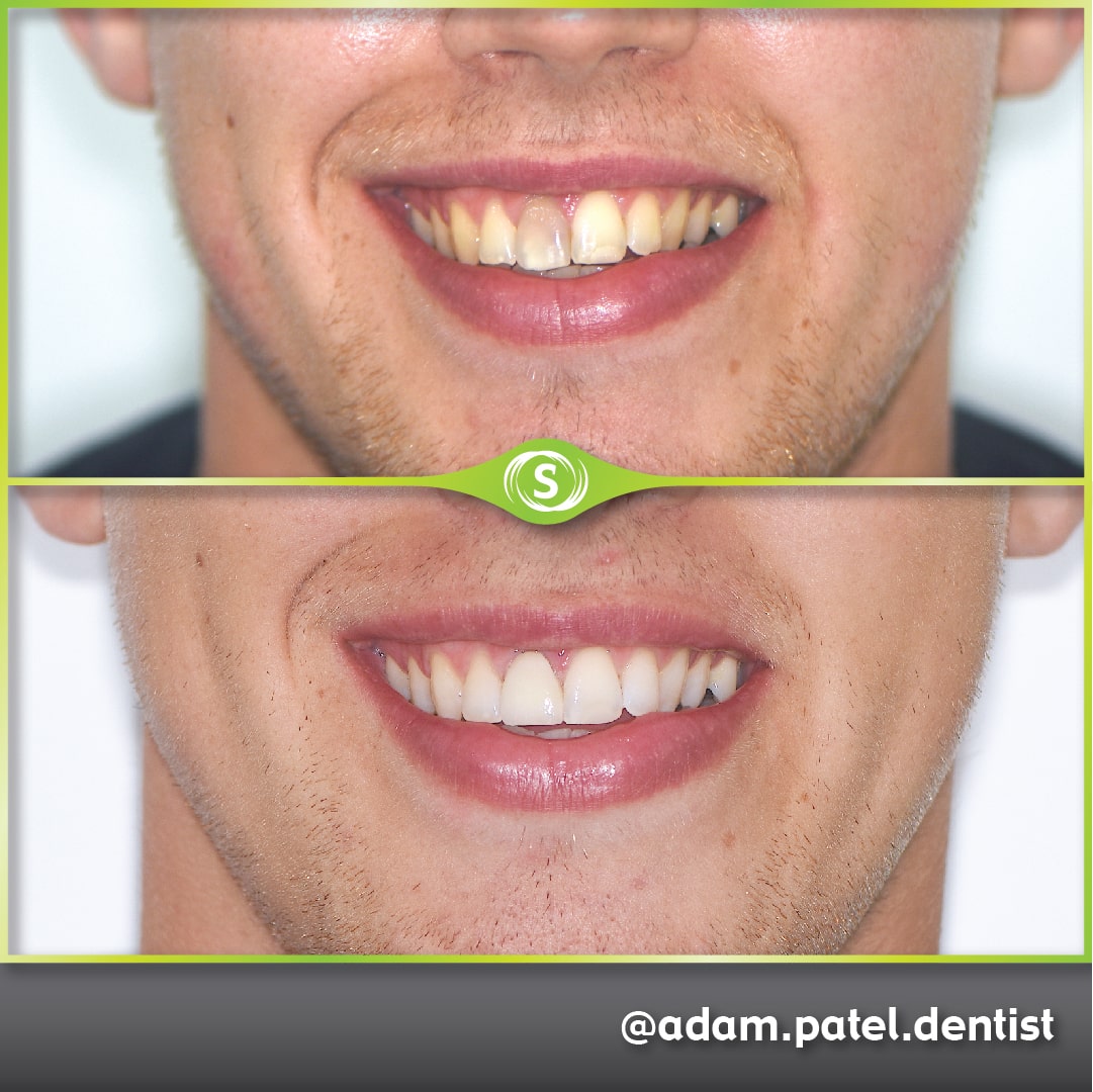 B&A Whitening AP-min