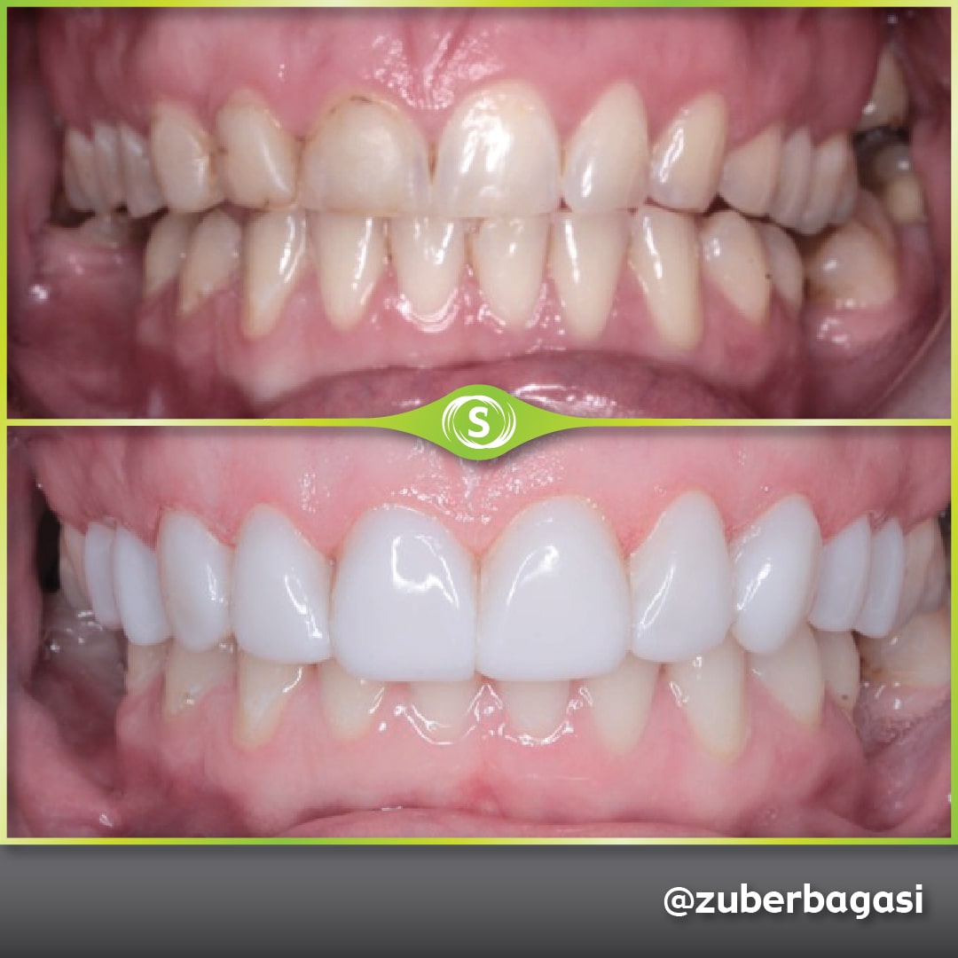 B&A Comp Bond SA ZB 1-min (1)