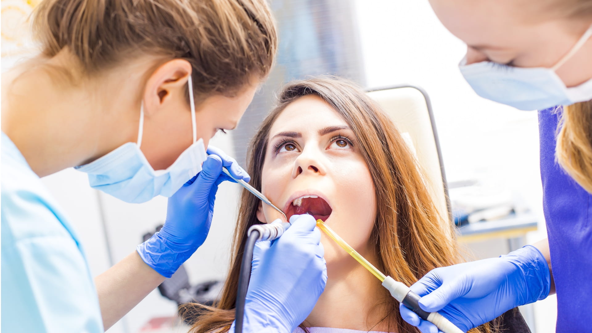 Composite bonding - Everything you need to know