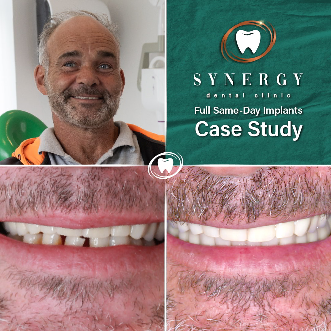 Before_and_After_Case_Study_Frame_-_FSDI_2_NL