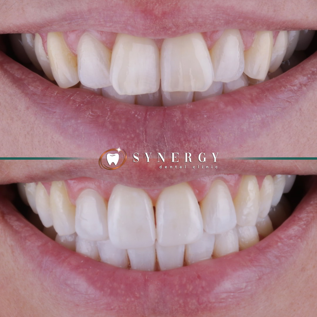 Dr. Mo Patel - Synergy Bolton - Invisalign